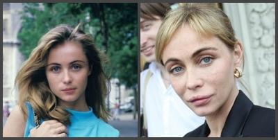 Кудрявцева впервые вышла в свет после тяжелой операции на бюсте Кудрявцева впервые вышла в свет после тяжелой операции на бюсте