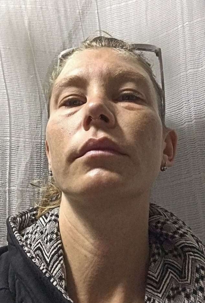 Дама не пьёт воду год и говорит, что стала здоровее. Но, глядя на её фото, люди не верят в пользу этого метода Дама не пьёт воду год и говорит, что стала здоровее. Но, глядя на её фото, люди не верят в пользу этого метода