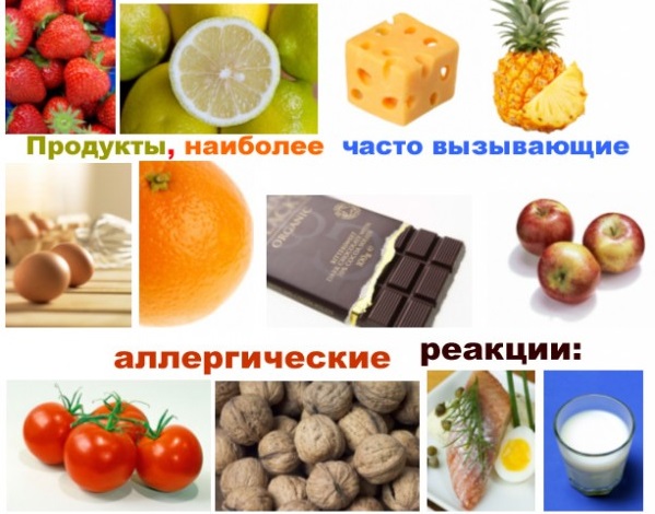 Аллергическая экзема на руках -лечение, экзогенный аллергический альвеолит