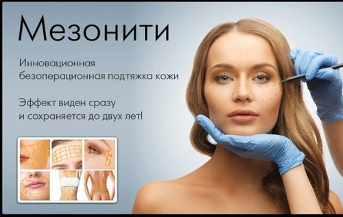 Тредлифтинг лица 3D мезонитями и виды нитей для подтяжки Тредлифтинг лица 3D мезонитями и виды нитей для подтяжки