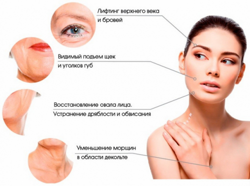 Процедура векторного лифтинга с фото до и после