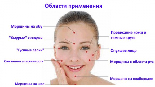 Метод иглоукалывания для омоложения лица Метод иглоукалывания для омоложения лица