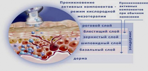 Достоинства и проведение кислородной мезотерапии Достоинства и проведение кислородной мезотерапии