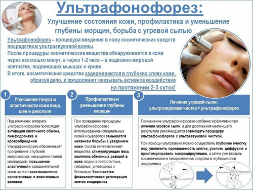 Преимущества ультрафонофореза и препараты для процедуры